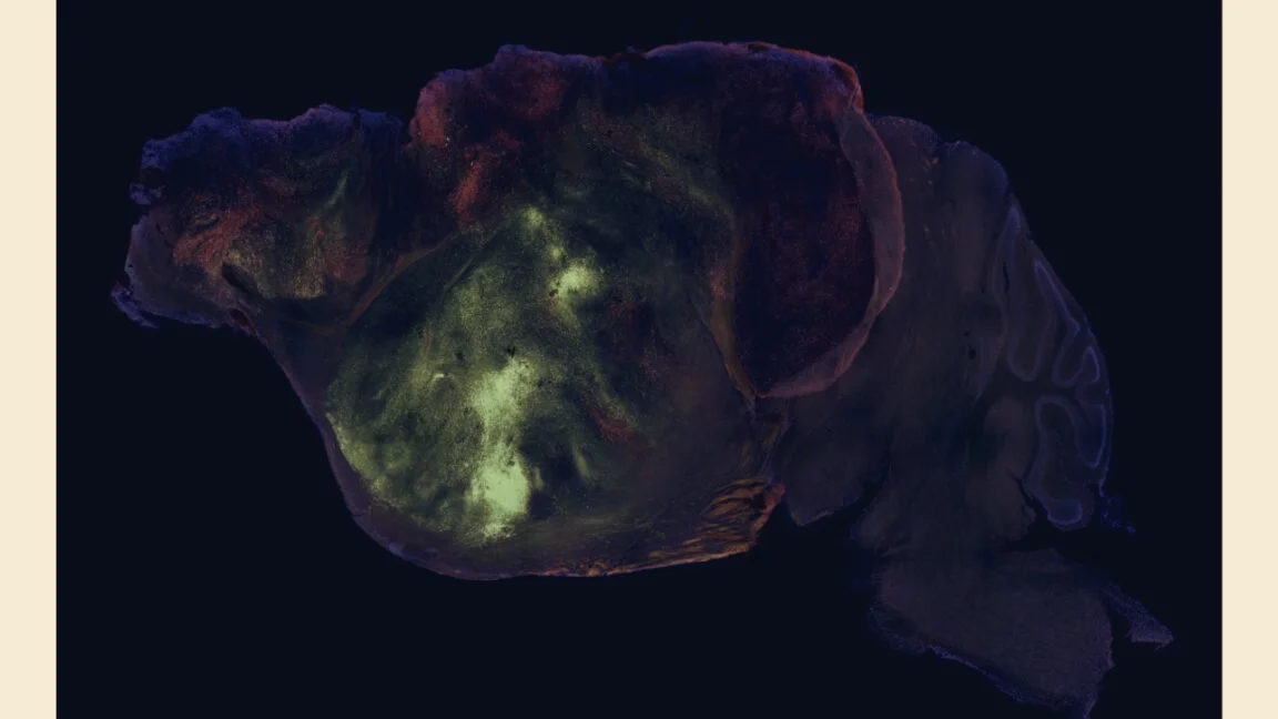 Stanford Replaces Mouse Cortex With Human Brain Organoid Cells, Shows Modest Gain